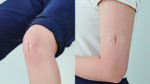 Cierre Cutáneo - Surginus Foldable Skin Closure - Imagen 4